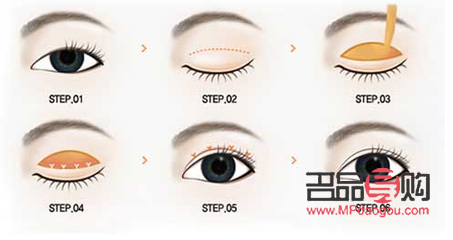 <h3>双眼皮的魅力：探索双眼皮的多样性与美学价值</h3>