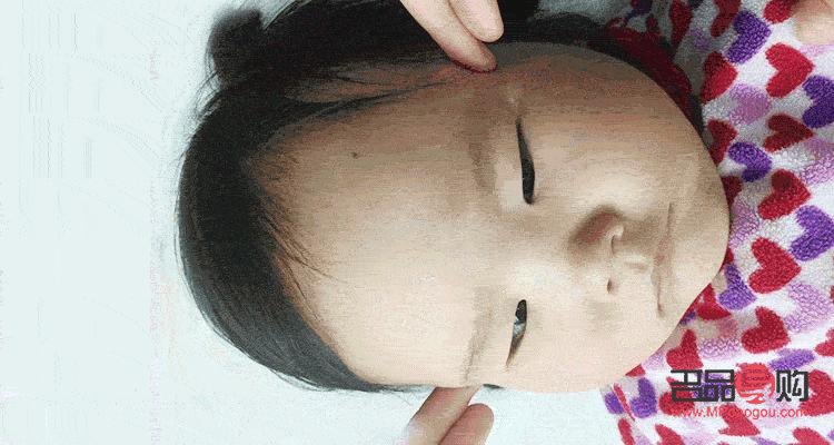 眼角塌陷怎么回事(眼角塌陷怎么回事图片)