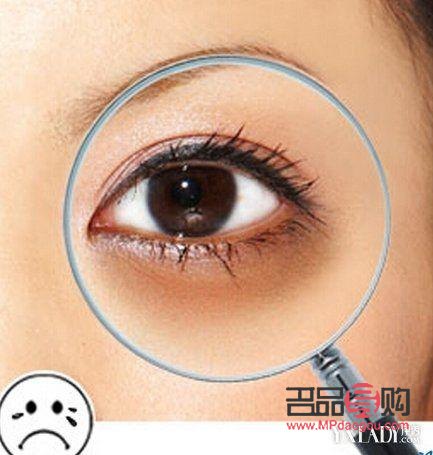 十几年的黑眼圈怎么去除(十几年的黑眼圈怎么去除掉) 十几年的黑眼圈怎么去除(十几年的黑眼圈怎么去除掉)