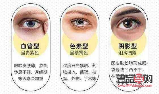 十几年的黑眼圈怎么去除(十几年的黑眼圈怎么去除掉)