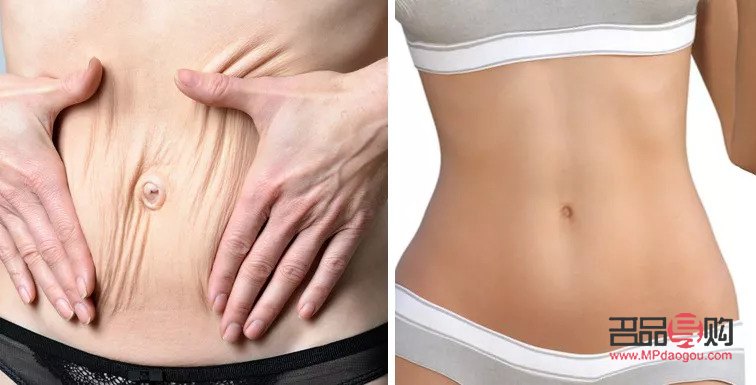 <h1>身体过敏后的护理之道</h1>