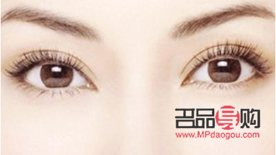 全切双眼皮恢复之路：时间与自然的完美融合