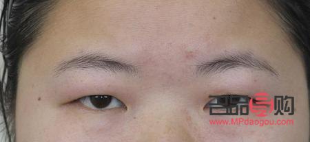 上眼皮肿眼泡是怎么回事(上眼皮肿眼泡是怎么回事啊)