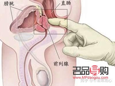 男性前列腺美容吗(男性前列腺美容吗能治好吗)