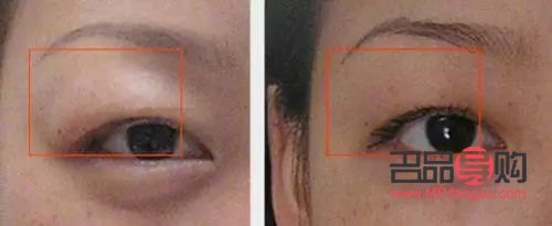 肿眼泡应该怎么改善(肿眼泡怎么改善啊)