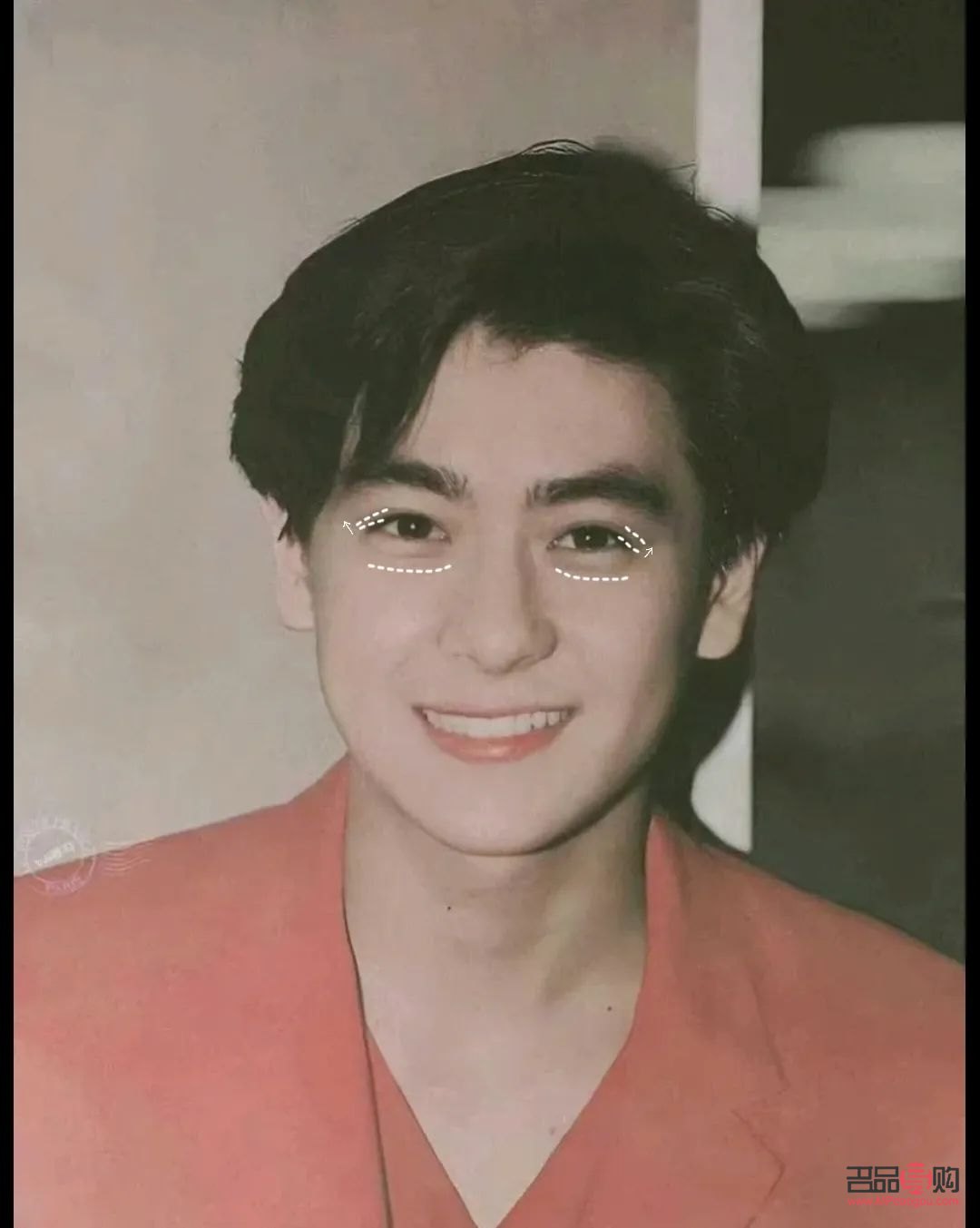 <h3>开扇双眼皮：魅力眼神的秘诀</h3>