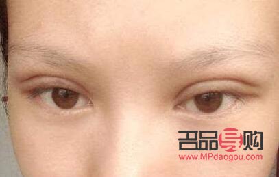 双眼皮肉条感是什么样子(双眼皮肉条感是什么样子的)