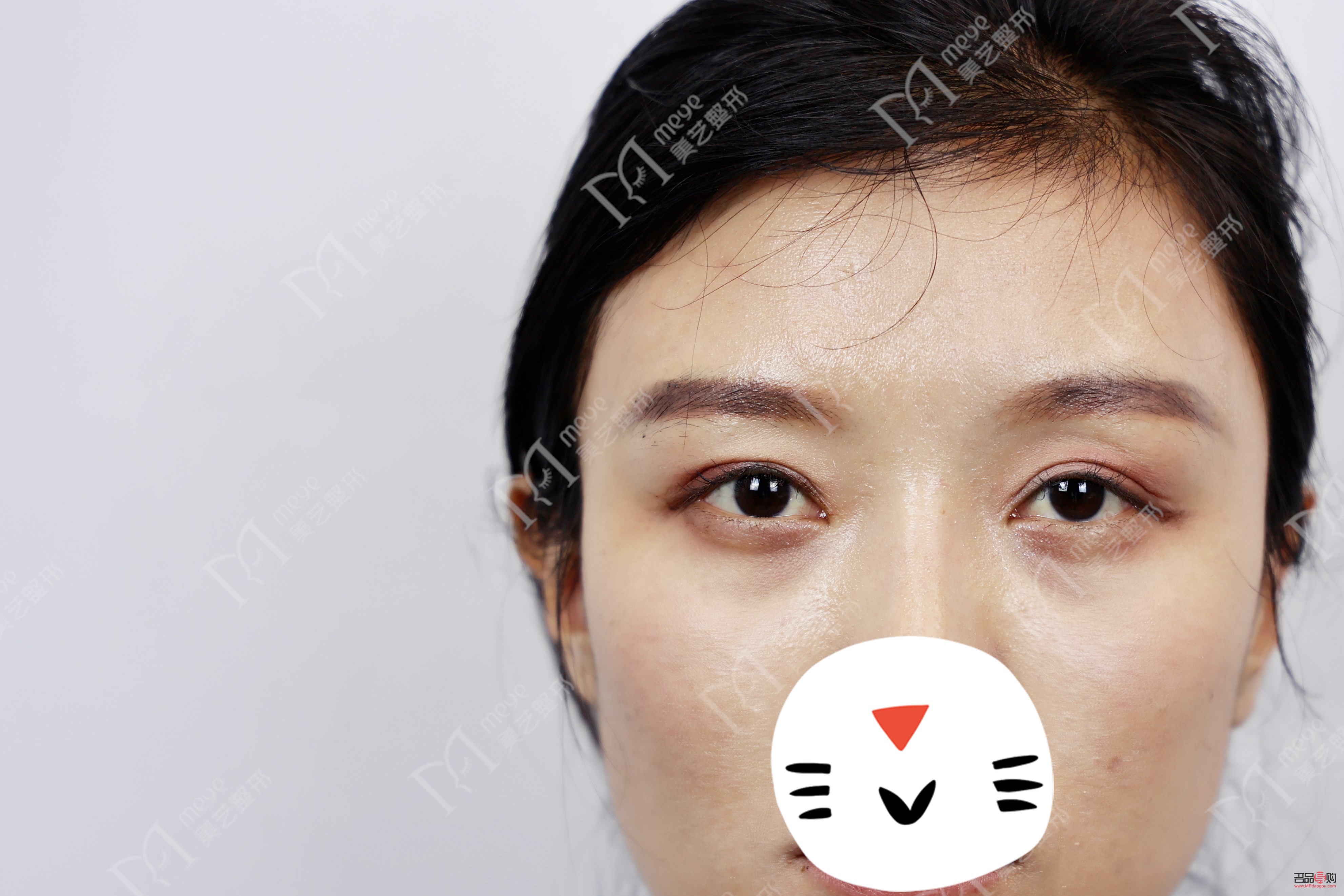 双眼皮肉条感是什么样子(双眼皮肉条感是什么样子的)