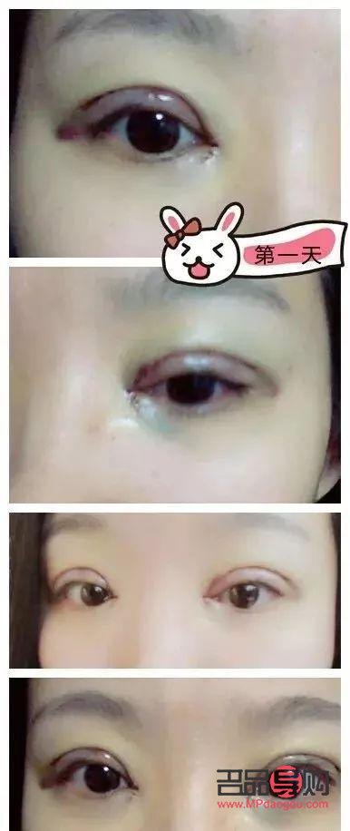 外双眼皮好看还是内双眼皮好看(外双眼皮好看还是内双眼皮好看呢)