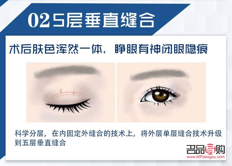 全切眼综合涵盖的眼部疾病范围