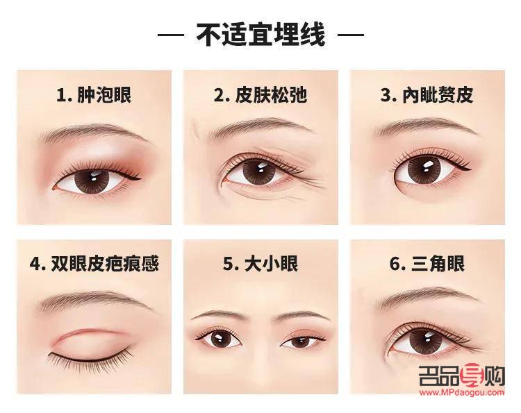 全切眼综合涵盖的眼部疾病范围