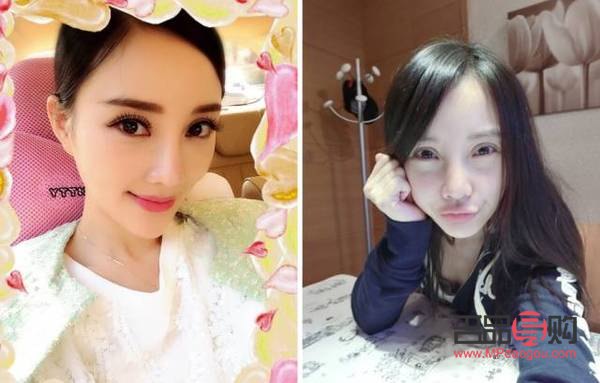 大双眼皮图片(欧式大双眼皮图片)