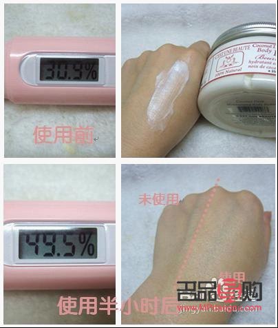 身体火烧怎么护理(身体火烧怎么护理最好)