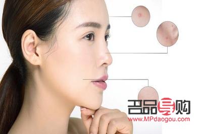 美容院怎么去粉刺(美容院怎么去粉刺的) 美容院怎么去粉刺(美容院怎么去粉刺的)