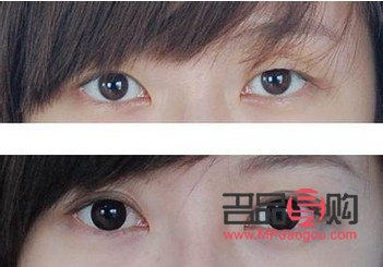 <h3>双眼皮翘睫手术:绽放双眼魅力,实现自然美眸</h3> <h3>双眼皮翘睫手术:绽放双眼魅力,实现自然美眸</h3>