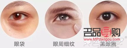 眼部衰老是什么原因(眼部衰老是什么原因造成的) 眼部衰老是什么原因(眼部衰老是什么原因造成的)