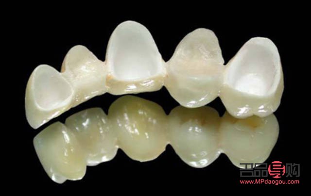 美容冠真的不好吗(美容冠真的不好吗) 美容冠真的不好吗(美容冠真的不好吗)