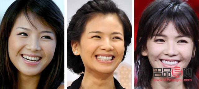 美容冠真的不好吗(美容冠真的不好吗) 美容冠真的不好吗(美容冠真的不好吗)