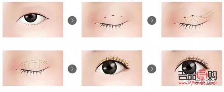 <h3>单眼皮变双眼皮秘籍:非手术方法大揭秘</h3> <h3>单眼皮变双眼皮秘籍:非手术方法大揭秘</h3>