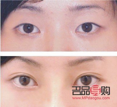 双眼皮类型(双眼皮类型哪个最好看)