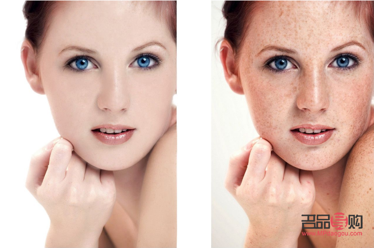 激光美容维持多久(激光美容维持多久可以洗脸)