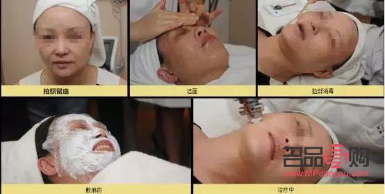 微针美容怎么做(微针美容步骤)