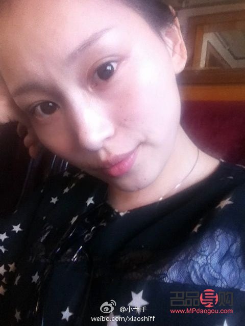 弄双眼皮会有后遗症吗(弄双眼皮会有后遗症吗知乎)