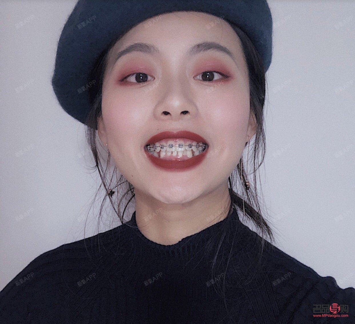 钢牙妹怎么护理身体(钢牙妹怎么护理身体健康)