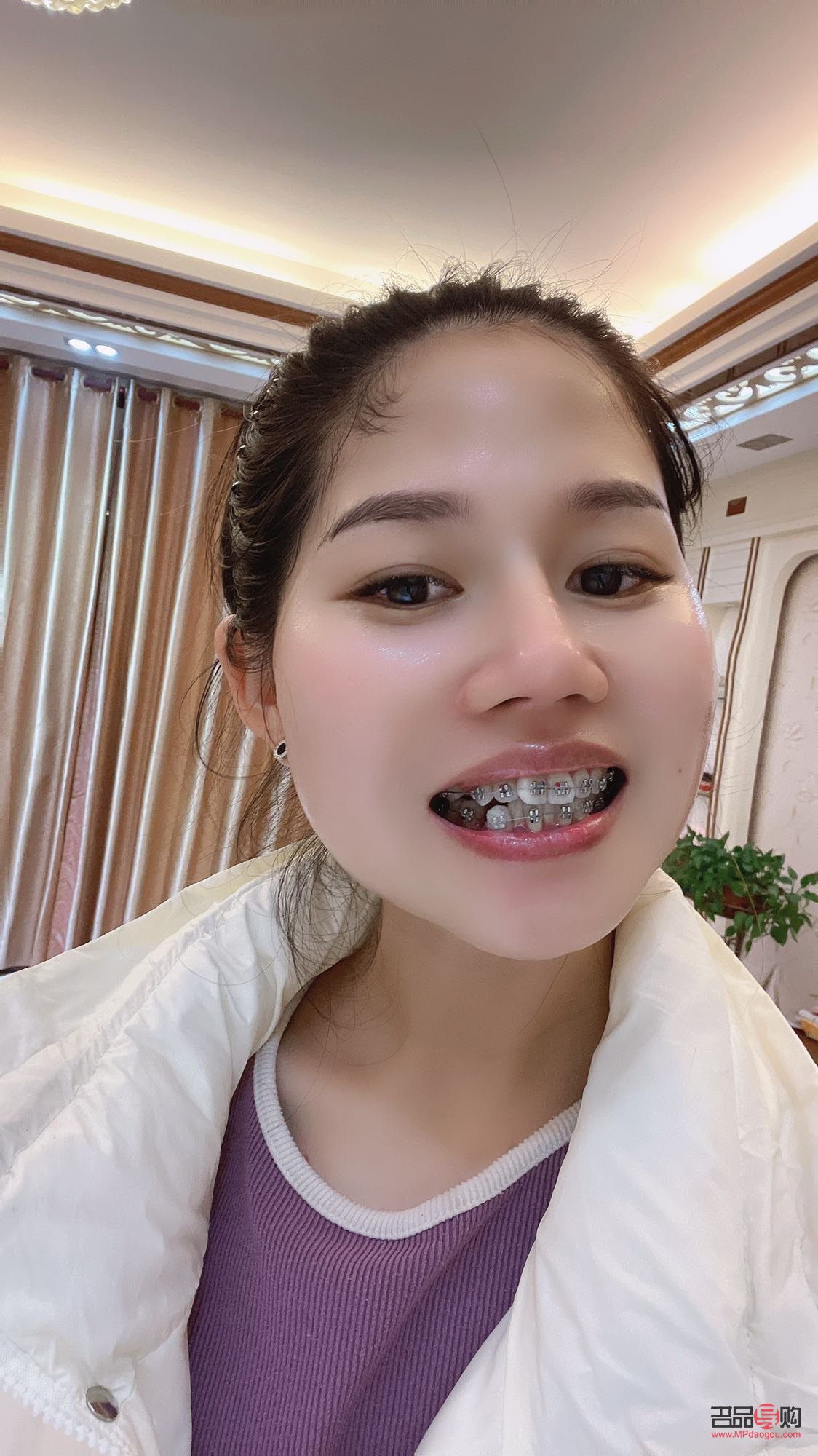 钢牙妹怎么护理身体(钢牙妹怎么护理身体健康)