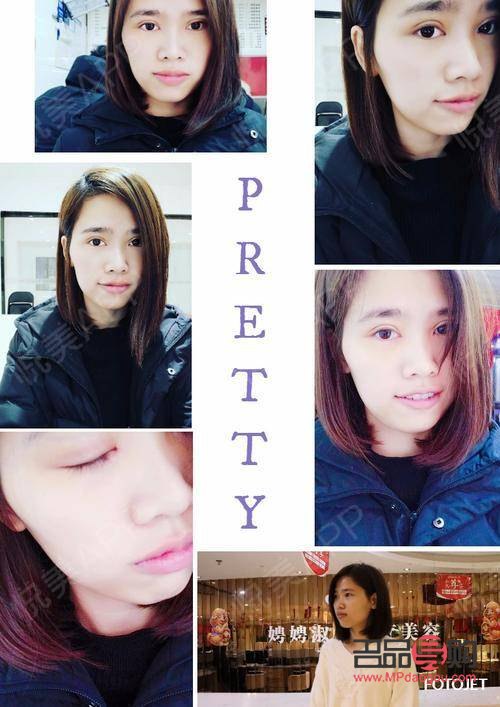 割双眼皮后多久恢复自然(割双眼皮后多久恢复自然一点) 割双眼皮后多久恢复自然(割双眼皮后多久恢复自然一点)