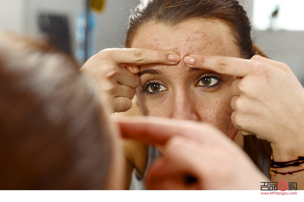 <h3>身体痘痘护理全攻略：告别烦恼，重拾肌肤健康</h3>