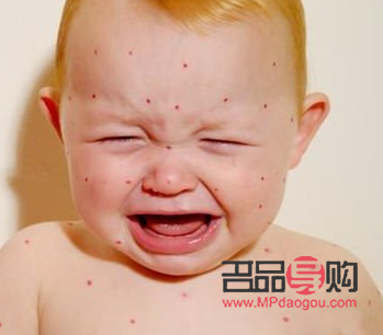 过敏身体怎么护理好(过敏身体怎么护理好呢)