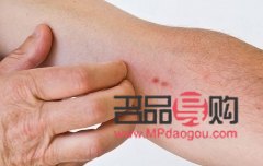 过敏身体怎么护理好(过敏身体怎么护理好呢)