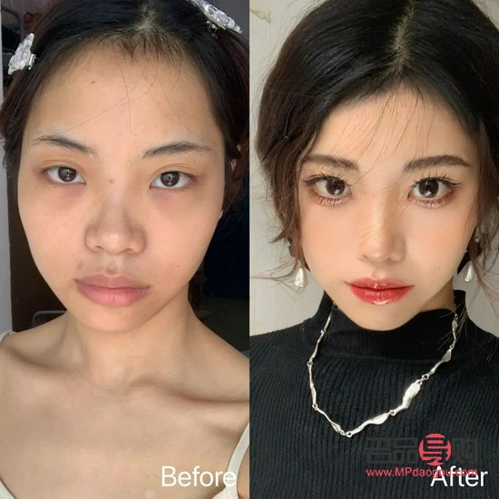 <h3>美容切眉：真的能让我们更年轻吗？</h3>