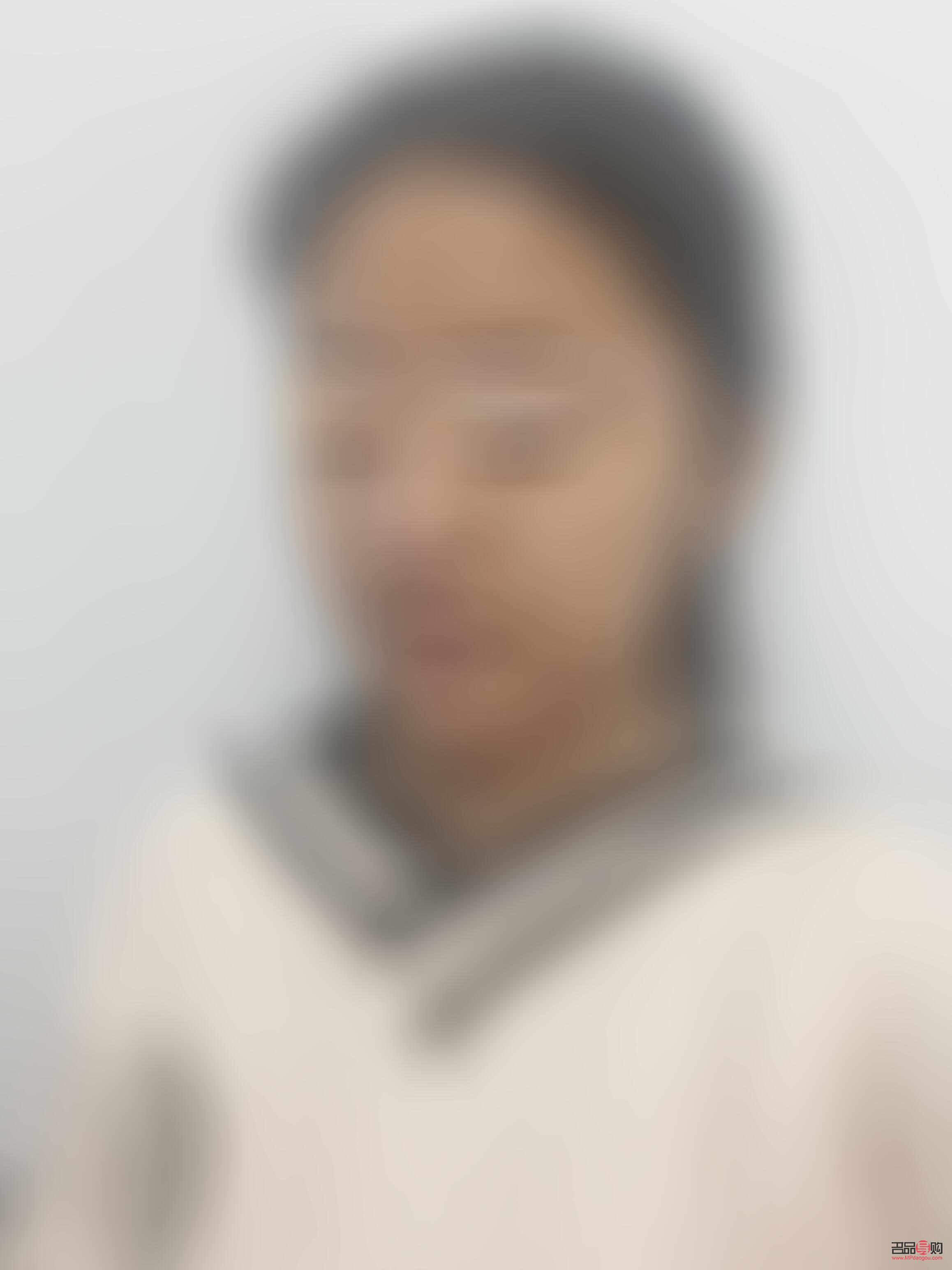 <h3>眼综合20天依然肿胀，如何应对？</h3>