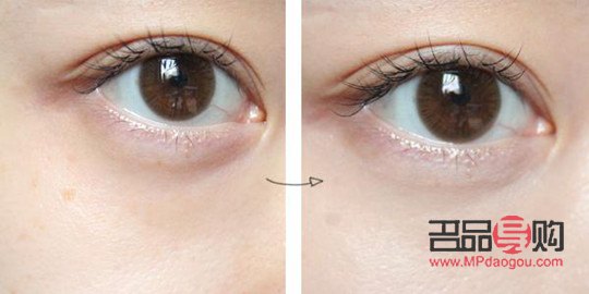 学生党怎样去眼袋(学生去眼袋小妙招)