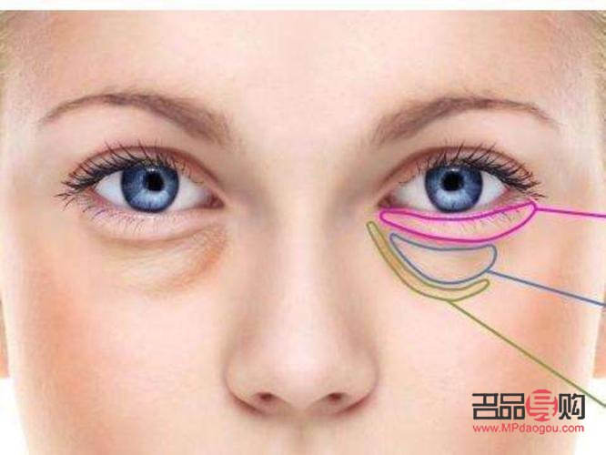 提拉眼角是不是辱华(提拉眼角多少钱)
