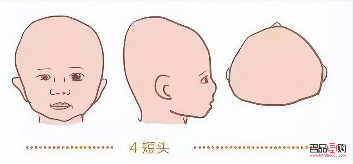 怎样改善大小眼(怎样改善大小眼问题)