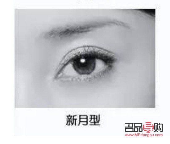 <h3>平行双眼皮改新月形双眼皮,你想知道的都在这里!</h3> <h3>平行双眼皮改新月形双眼皮,你想知道的都在这里!</h3>