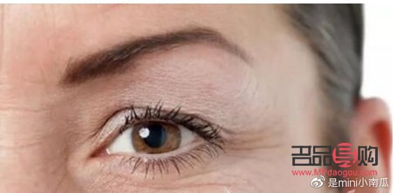 眼皮下垂是提眉好还是割双眼皮好(眼皮下垂是提眉好还是割双眼皮好呢)