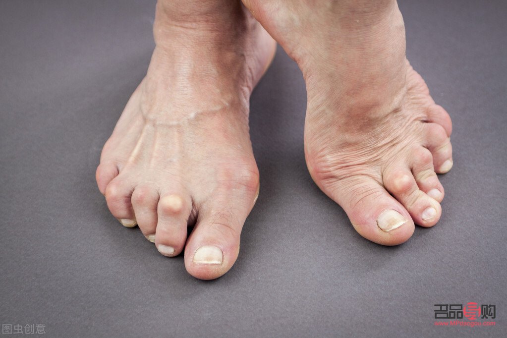 <h3>雨天是否适宜做身体护理？</h3>