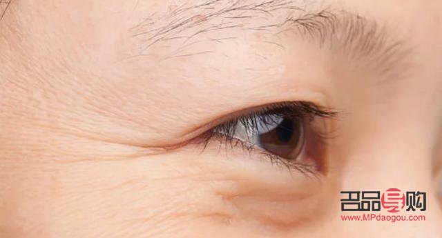 眼睛下边长皱纹是怎么回事(眼睛下边长皱纹是怎么回事儿)