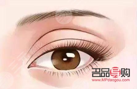 眼角下垂手术大概得多少钱(做双眼皮手术要多久才能恢复好)