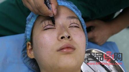 双眼皮手术后的“显老”之忧