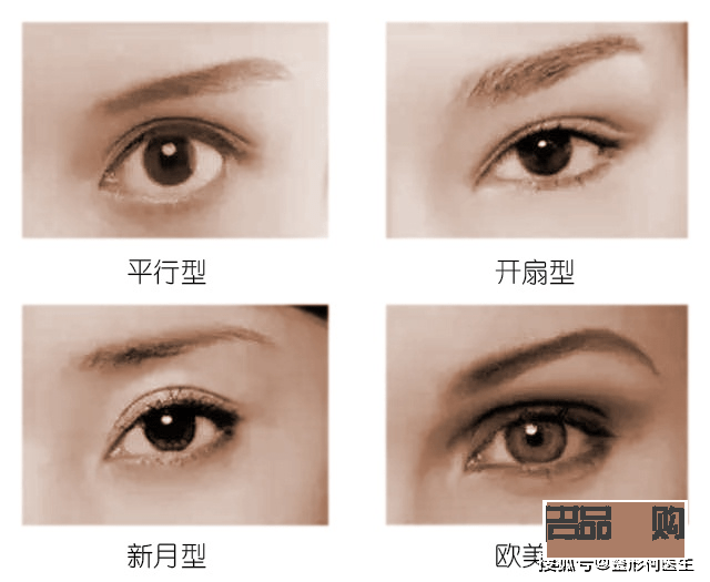 <h3>割双眼皮30天恢复图真实记录</h3> <h3>割双眼皮30天恢复图真实记录</h3>