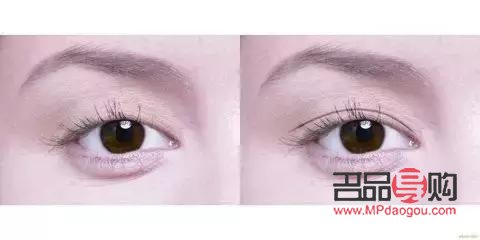 四十岁双眼皮下垂了怎么办(四十多岁变双眼皮了)