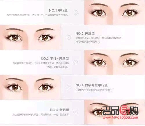 探索双眼皮的魅力：哪一种形状更适合你？