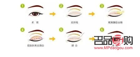 <h3>消除肿眼泡的有效方法</h3>