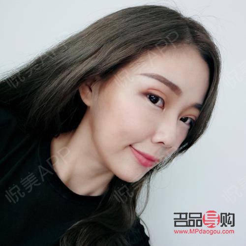 <h3>双眼皮手术疤痕真相揭秘:了解、预防与治疗全攻略</h3> <h3>双眼皮手术疤痕真相揭秘:了解、预防与治疗全攻略</h3>