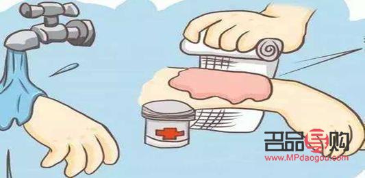 身体烫伤后最佳护理方法全解析